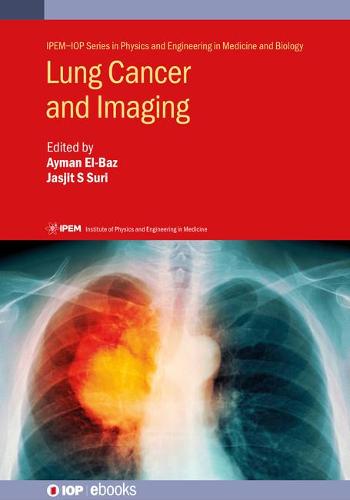 Lung Cancer and Imaging - IPEM-IOP Series in Physics and Engineering in Medicine and Biology (Hardback)
