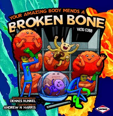 Your Amazing Body Mends a Broken Bone - Your Amazing Body No. 1 (Paperback)
