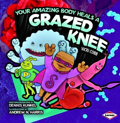 Your Amazing Body Heals a Grazed Knee - Your Amazing Body No. 5 (Paperback)