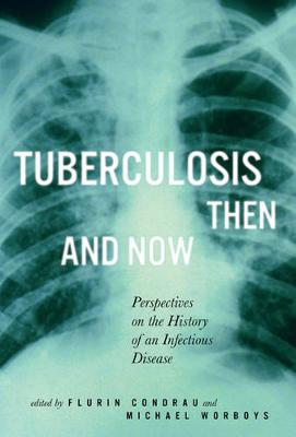 Tuberculosis Then and Now: Perspectives on the History of an Infectious Disease - McGill-Queen's/Associated McGill-Queen's/Associated Medical Services Studies in the History of Medic (Paperback)