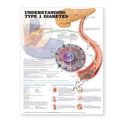 Understanding Type 1 Diabetes Anatomical Chart (Wallchart)