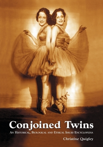 Conjoined Twins: An Historical, Biological and Ethical Issues Encyclopedia (Paperback)