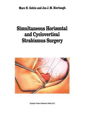 Simultaneous Horizontal and Cyclovertical Strabismus Surgery - Monographs in Ophthalmology 15 (Hardback)