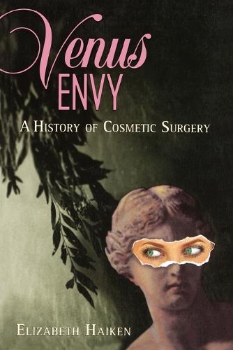 Venus Envy: A History of Cosmetic Surgery (Paperback)