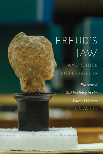 Freud's Jaw and Other Lost Objects: Fractured Subjectivity in the Face of Cancer (Paperback)