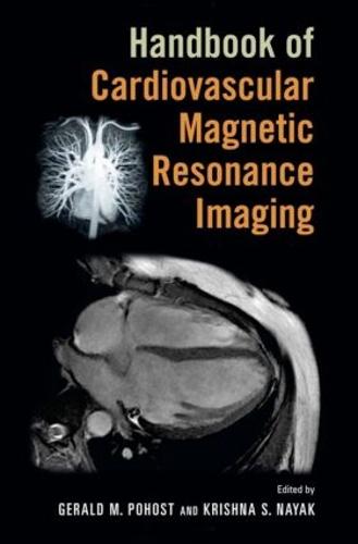 Handbook of Cardiovascular Magnetic Resonance Imaging - Fundamental and Clinical Cardiology (Hardback)