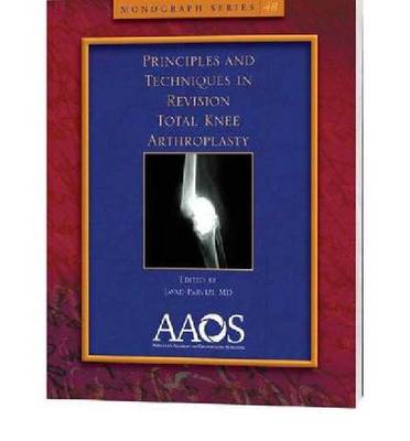 Principles and Techniques in Revision Total Knee Arthroplasty - Monograph Series (Paperback)