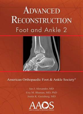 Advanced Reconstruction: Foot and Ankle 2 - Advanced Reconstruction (Hardback)