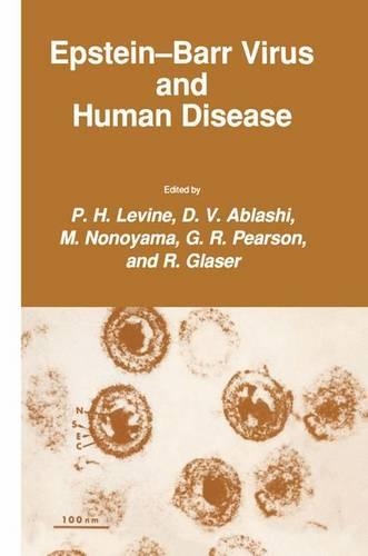 Epstein-Barr Virus and Human Disease - Experimental Biology and Medicine 15 (Hardback)