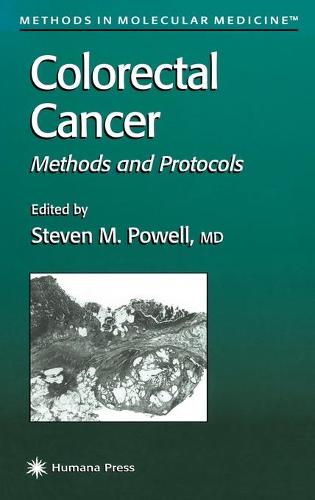 Colorectal Cancer: Methods and Protocols - Methods in Molecular Medicine 50 (Hardback)