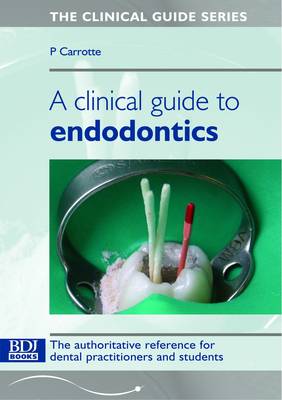 Clinical Guide to Endodontics - Clinical Guide S. (Paperback)
