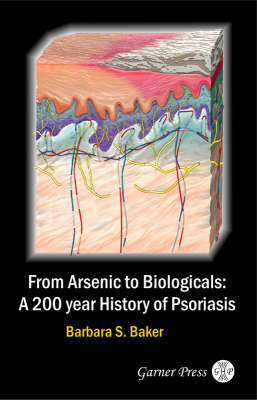 From Arsenic to Biologicals: A 200 Year History of Psoriasis (Paperback)