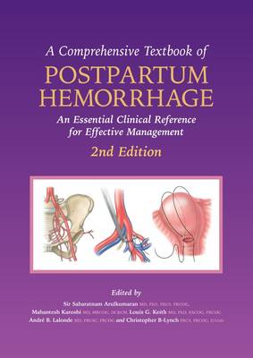 A Comprehensive Textbook of Postpartum Hemorrhage: An Essential Clinical Reference for Effective Management (Paperback)