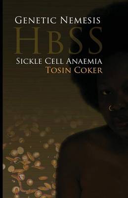 Genetic Nemesis HbSS: Sickle Cell Anaemia (Paperback)