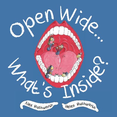 Open Wide... What's Inside? (Paperback)