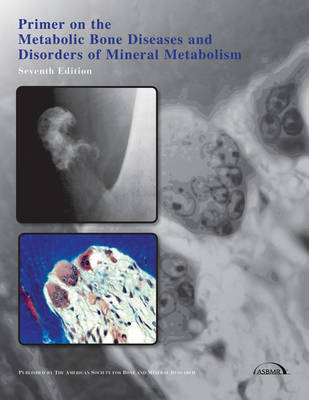 Primer on the Metabolic Bone Diseases and Disorders of Mineral Metabolism (Paperback)