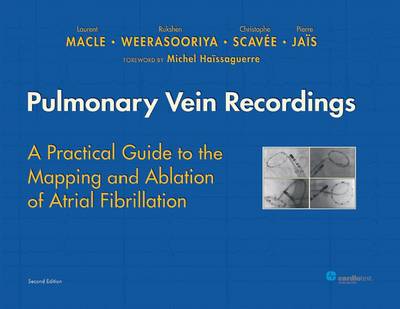 Pulmonary Vein Recordings: A Practical Guide to the Mapping and Ablation of Atrial Fibrillation (Hardback)