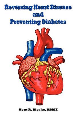Reversing Heart Disease and Preventing Diabetes: Apply Science to Lower Cholesterol 100 Points; Reduce Arterial Plaque 50% in 25 Months; and Improve Heart Rhythm and Valves (Paperback)