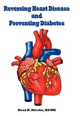 Reversing Heart Disease and Preventing Diabetes: Apply Science to Lower Cholesterol 100 Points; Reduce Arterial Plaque 50% in 25 Months; and Improve Heart Rhythm and Valves (Hardback)