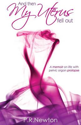 And Then My Uterus Fell Out (Paperback)