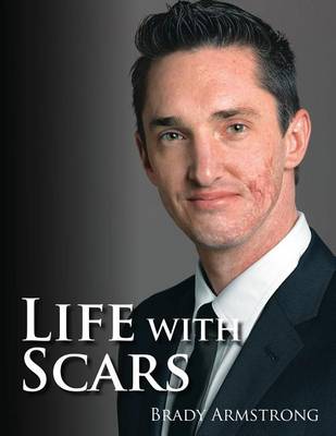 Life with Scars: A Guide to Emotionally Overcoming Physical Trauma (Paperback)