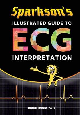 Sparkson's Illustrated Guide to ECG Interpretation (Paperback)