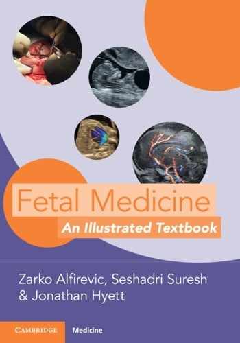 Zarko Alfirevic Fetal Medicine