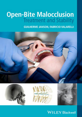 Open-Bite Malocclusion: Treatment and Stability (Paperback)