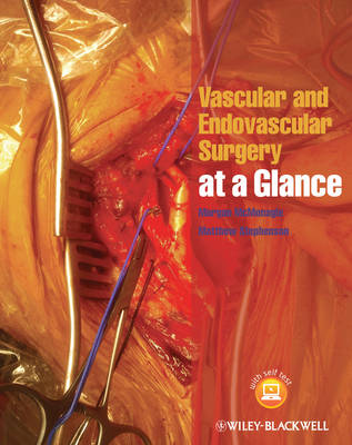 Vascular and Endovascular Surgery at a Glance - At a Glance (Paperback)