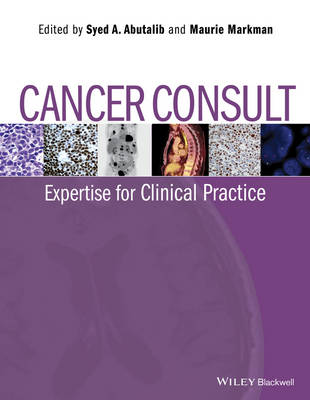 Cancer Consult: Expertise for Clinical Practice (Paperback)