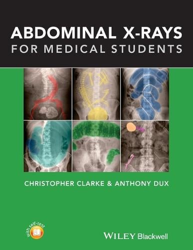 Abdominal X-rays for Medical Students (Paperback)