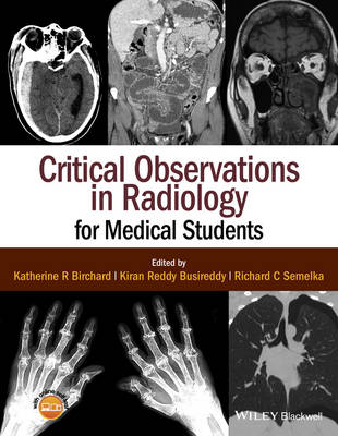 Critical Observations in Radiology for Medical Students (Paperback)