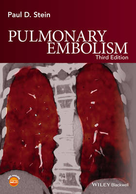 Pulmonary Embolism (Hardback)