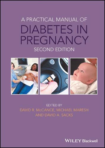 Cover A Practical Manual of Diabetes in Pregnancy - Practical Manual of Series