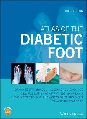 Atlas of the Diabetic Foot (Hardback)