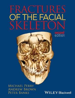 Fractures of the Facial Skeleton (Paperback)