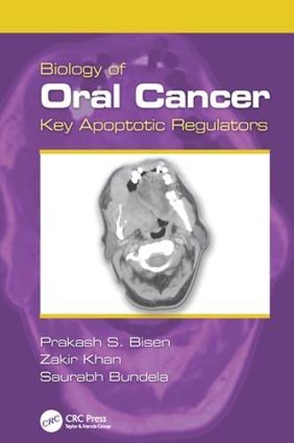 Biology of Oral Cancer: Key Apoptotic Regulators (Paperback)
