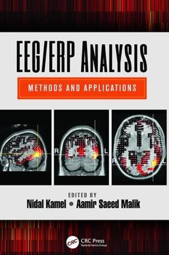 EEG/ERP Analysis: Methods and Applications (Paperback)