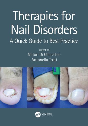 Therapies for Nail Disorders: A Quick Guide to Best Practice (Paperback)