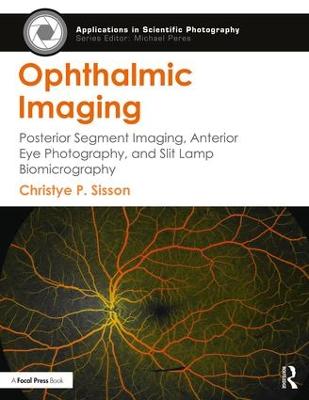 Ophthalmic Imaging: Posterior Segment Imaging, Anterior Eye Photography, and Slit Lamp Biomicrography - Applications in Scientific Photography (Paperback)