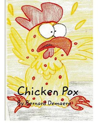 Chicken Pox (Paperback)
