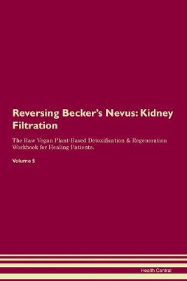 Reversing Becker's Nevus: Kidney Filtration The Raw Vegan Plant-Based Detoxification & Regeneration Workbook for Healing Patients. Volume 5 (Paperback)