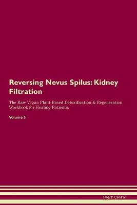 Reversing Nevus Spilus: Kidney Filtration The Raw Vegan Plant-Based Detoxification & Regeneration Workbook for Healing Patients.Volume 5 (Paperback)