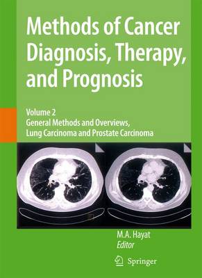 Methods of Cancer Diagnosis, Therapy and Prognosis: General Methods and Overviews, Lung Carcinoma and Prostate Carcinoma - Methods of Cancer Diagnosis, Therapy and Prognosis 2 (Hardback)