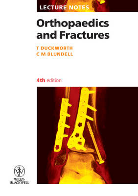 Orthopaedics and Fractures - Lecture Notes (Paperback)