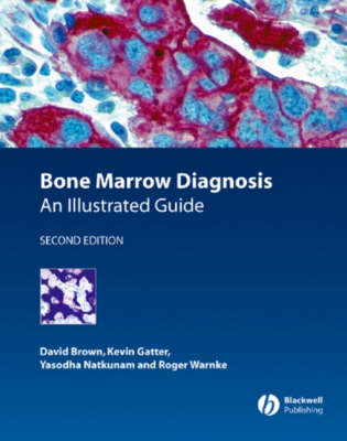 Bone Marrow Diagnosis: An Illustrated Guide (Hardback)