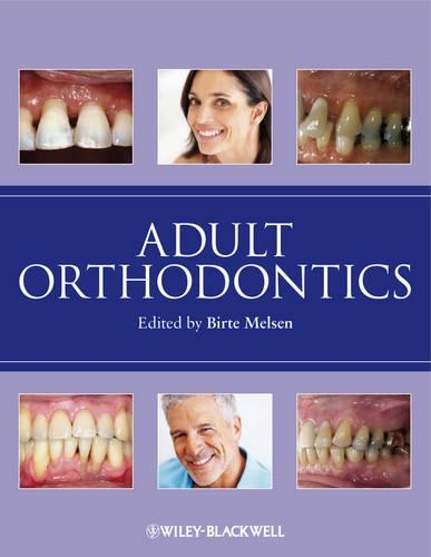 Adult Orthodontics (Hardback)