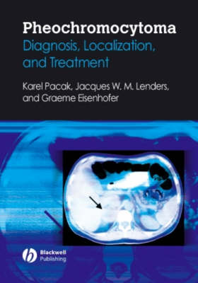 Pheochromocytoma: Diagnosis, Localization, and Treatment (Hardback)