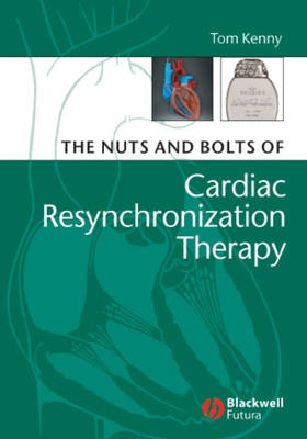 The Nuts and Bolts of Cardiac Resynchronization Therapy - Nuts and Bolts Series (Replaced by 5113) (Paperback)