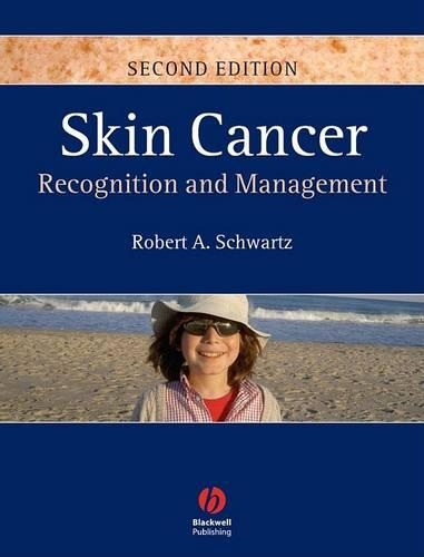 Skin Cancer: Recognition and Management (Hardback)